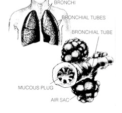 Mucous plugs up bronchial tubes during a cold, particularly in small children